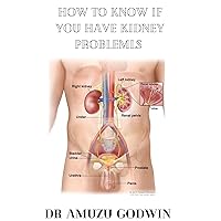 How to know if you have kidney problem : Sign and symptoms of kidney problem How to know if you have kidney problem : Sign and symptoms of kidney problem Kindle Paperback