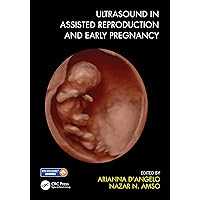 Ultrasound in Assisted Reproduction and Early Pregnancy Ultrasound in Assisted Reproduction and Early Pregnancy Kindle Hardcover Paperback