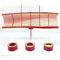 PVC Human Blood Vessel Model, Heart-Vascular Cholesterol Model, Thrombosis Process Anatomy Model, Medical Teaching Display Aids