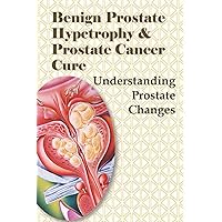 Benign Prostate Hypetrophy & Prostate Cancer Cure: Understanding Prostate Changes