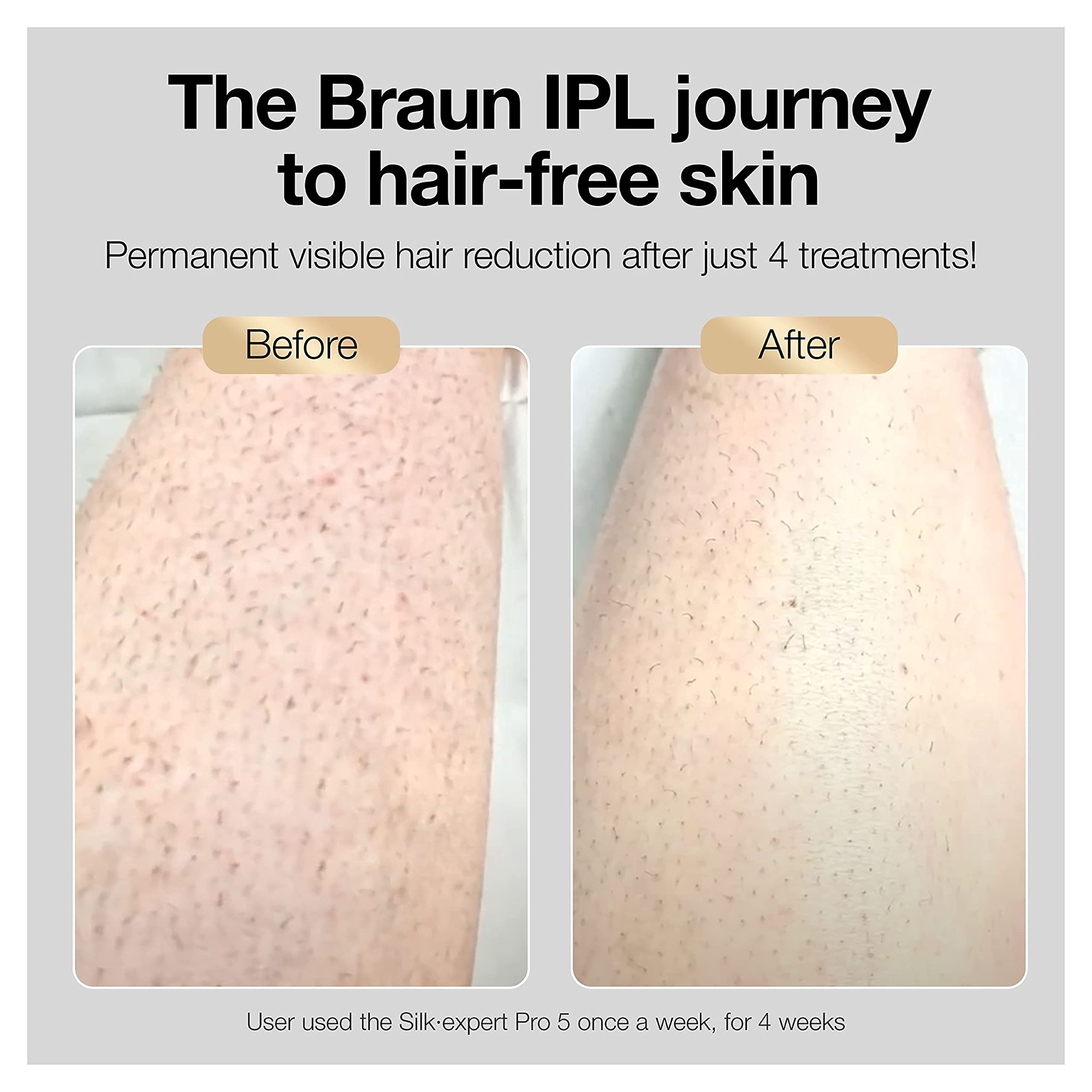 Braun IPL Long-lasting Hair Removal System for Women and Men, NEW Silk Expert Pro 5 PL5347, Head-to-toe Usage, for Body & Face, Alternative to Salon Laser Hair Removal, With 3 Extra Caps