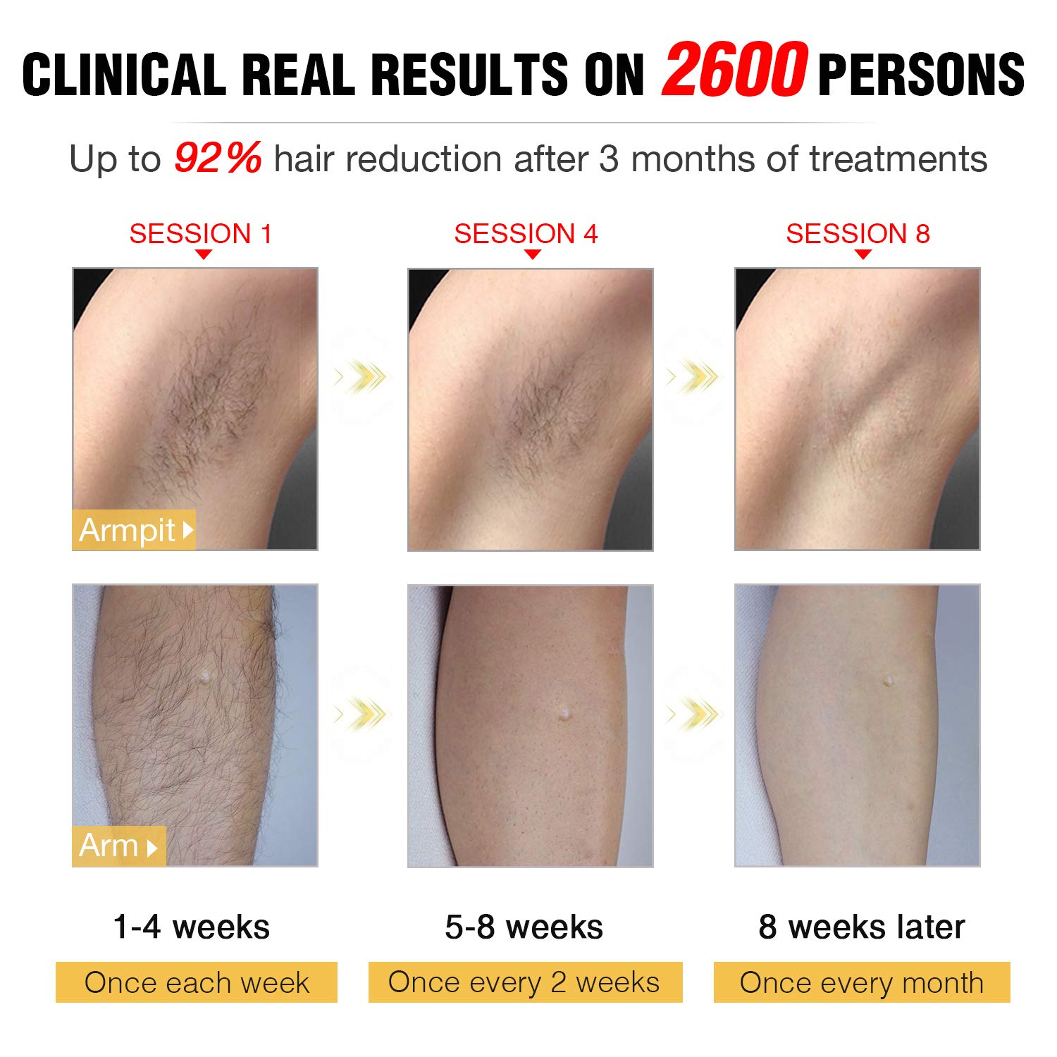 Mua Laser Hair Removal Permanent, IMENE Painless IPL Hair Removal - Ideal  for Women & Men Bikini, Legs, Arms, Armpits Hair Remover - Uses Most  Effective IPL Technology (Intense Pulsed Light) Yellow