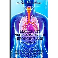 Malignant Neoplasm of the Bronchus and Lung (Medical care and health)