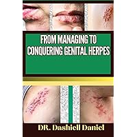 FROM MANAGING TO CONQUERING GENITAL HERPS : Expert Guide To Understanding the Causes, Recognizing Symptoms, Prevention and Embracing Effective Treatments for a Vibrant and Healthy Life FROM MANAGING TO CONQUERING GENITAL HERPS : Expert Guide To Understanding the Causes, Recognizing Symptoms, Prevention and Embracing Effective Treatments for a Vibrant and Healthy Life Kindle Paperback