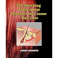 The Shocking Truth About Diseases that Cause Hair Loss: Secrets You Need to Know About Losing Hair So You Can Stop From Going Bald The Shocking Truth About Diseases that Cause Hair Loss: Secrets You Need to Know About Losing Hair So You Can Stop From Going Bald Paperback