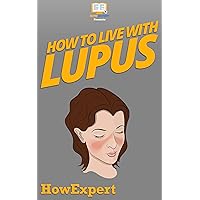 How To Live With Lupus: Your Step By Step Guide To Living With Lupus