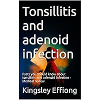 Tonsillitis and adenoid infection: Facts you should know about tonsillitis and adenoid infection - Medical review
