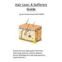 Hair Loss: A Sufferers Guide: Female hair loss, male pattern thinning, itchy scalp, psoriasis, eczema, alopecia, Sussex Trichology, hair and scalp specialist, cancer hair loss Hair Loss: A Sufferers Guide: Female hair loss, male pattern thinning, itchy scalp, psoriasis, eczema, alopecia, Sussex Trichology, hair and scalp specialist, cancer hair loss Kindle