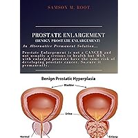 Prostate Enlargement(BPE). An Alternative Permanent Solution
