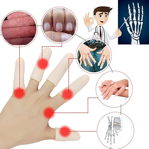 Gel Finger Cots, Finger Protector Support(14 PCS) NEW MATERIAL Finger Sleeves Great for Trigger Finger, Hand Eczema, Finger Cracking, Finger Arthritis and More. (10pcs Long + 4pcs Short)