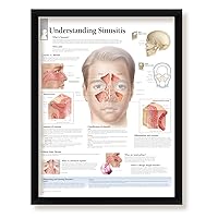 Understanding Sinusitis Framed Medical Educational Informational Poster Diagram Doctors Office School Classroom 22x28 Inches