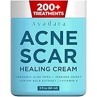 Acne Scar Healing Cream, 2 fl oz, Acne Scar Treatment for Face, Stretch Marks, Body Scars, Acne Scar Removal Cream for Body, Acne Scar Remover for Cuts and Burns, For All Skin Types, 200+ Uses