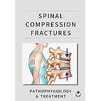 Spinal Compression Fractures: Pathophysiology ＆ Treatment