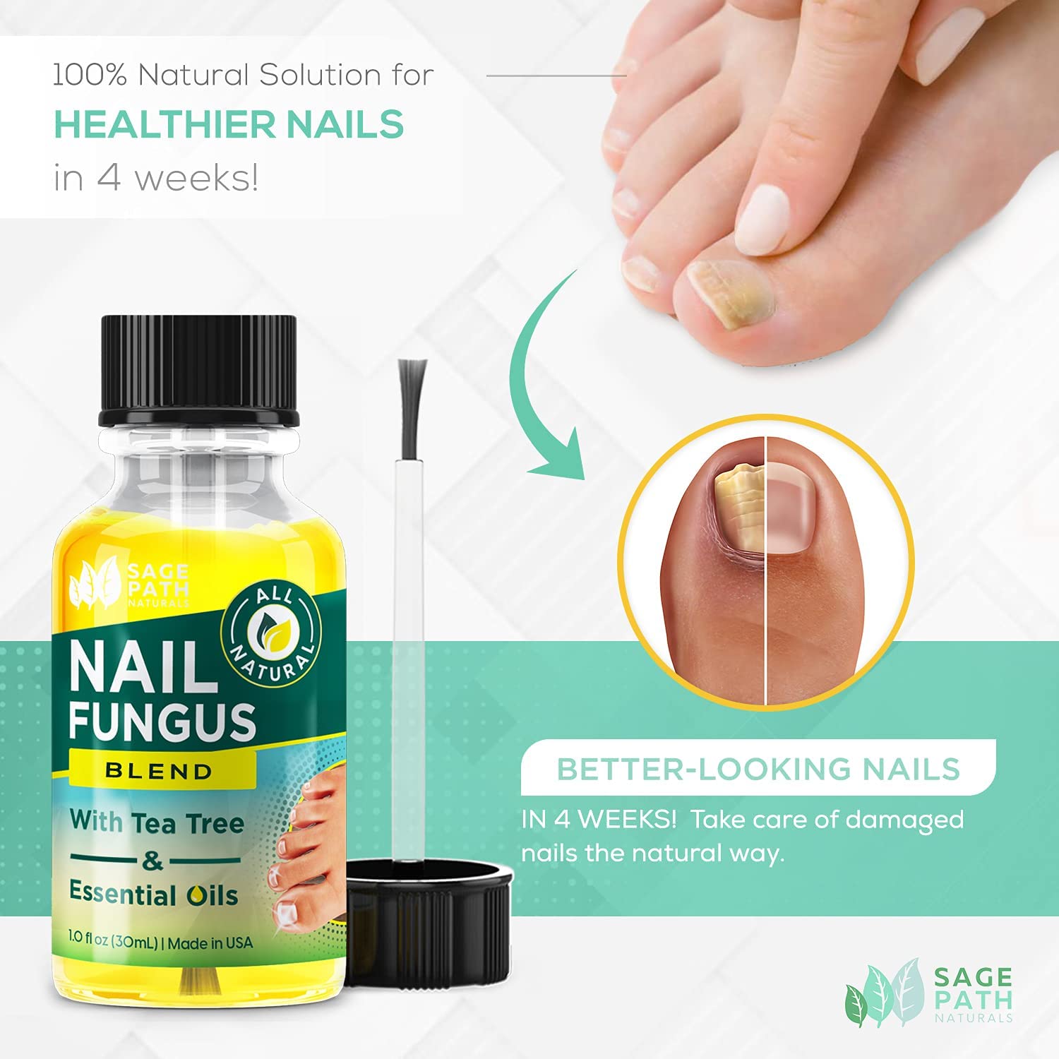 Fungal Nail Treatment Essential oil Hand and Foot Whitening Toe Nail Fungus  US^^ | eBay