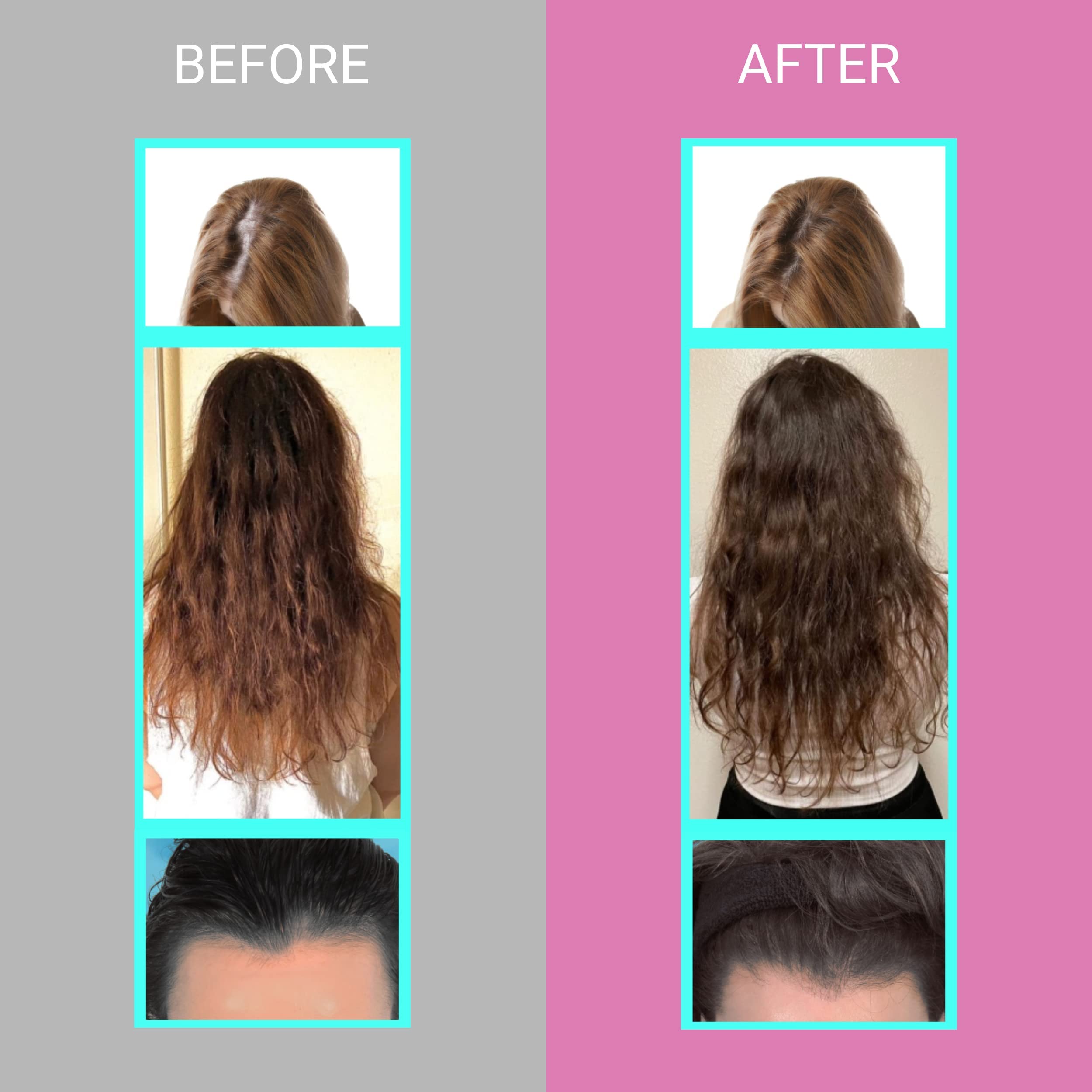 Mua Hair Growth Vitamins for Women - Proven Hair Supplement with KERANAT,  DHT Blocker PHYTOPIN, Biotin 5000 mcg & SOD, - Hair Vitamins for Faster  Hair Growth, Hair Loss & Thinning Hair -