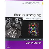 Brain Imaging: Case Review Series Brain Imaging: Case Review Series Paperback eTextbook Mass Market Paperback