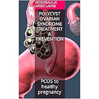 Polycyst Ovarian Syndrome Treatment & Prevention: PCOS to healthy pregnancy