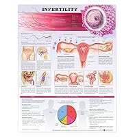 Infertility Anatomical Chart: (unmounted)