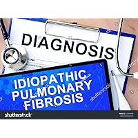 Key highlights on Idiopathic Pulmonary Fibrosis (IPF) : Every breathe matters. Key highlights on Idiopathic Pulmonary Fibrosis (IPF) : Every breathe matters. Kindle