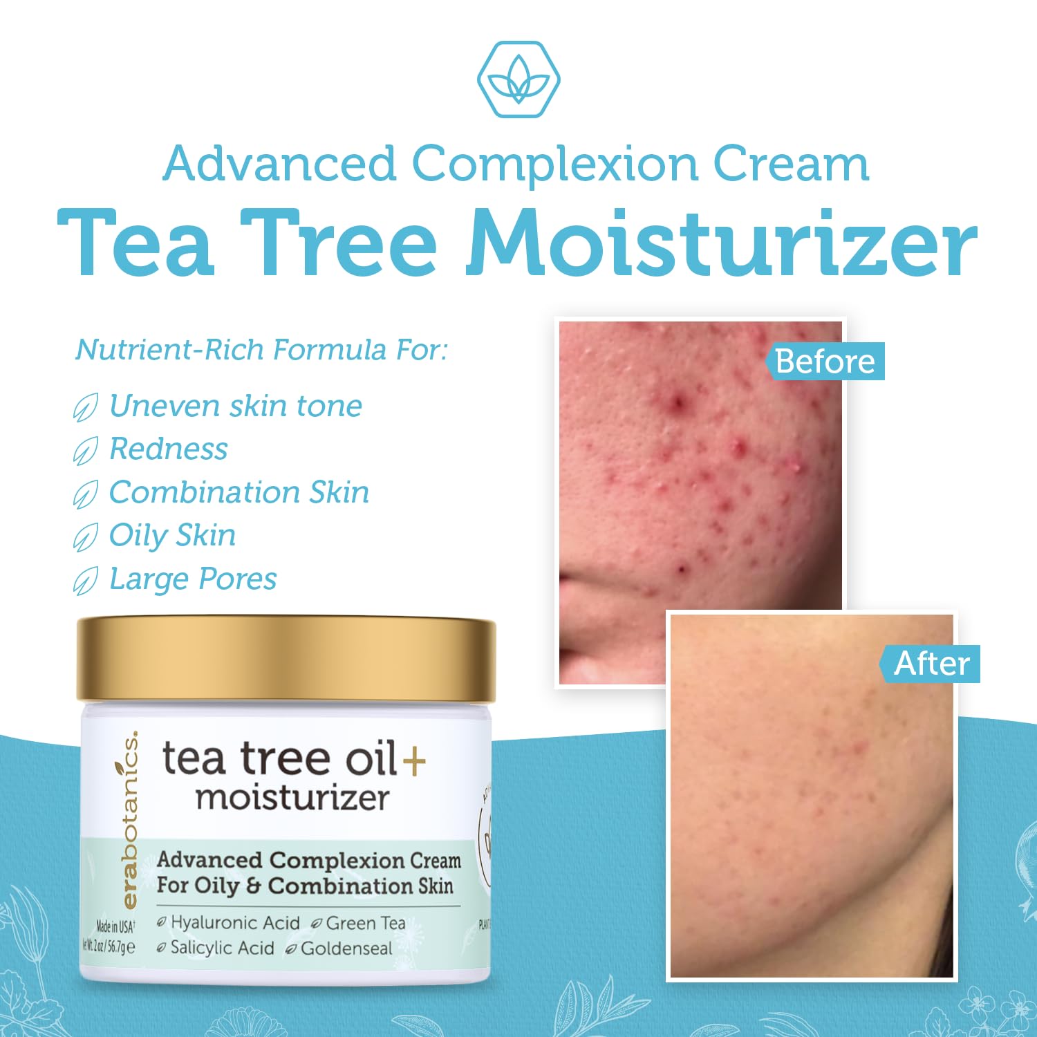Era Organics Tea Tree Cream Face Moisturizer for Oily Skin - Advanced 7X Balancing Oily Skin Moisturizer - Non-Greasy Moisturizer - Tea Tree Oil for Skin