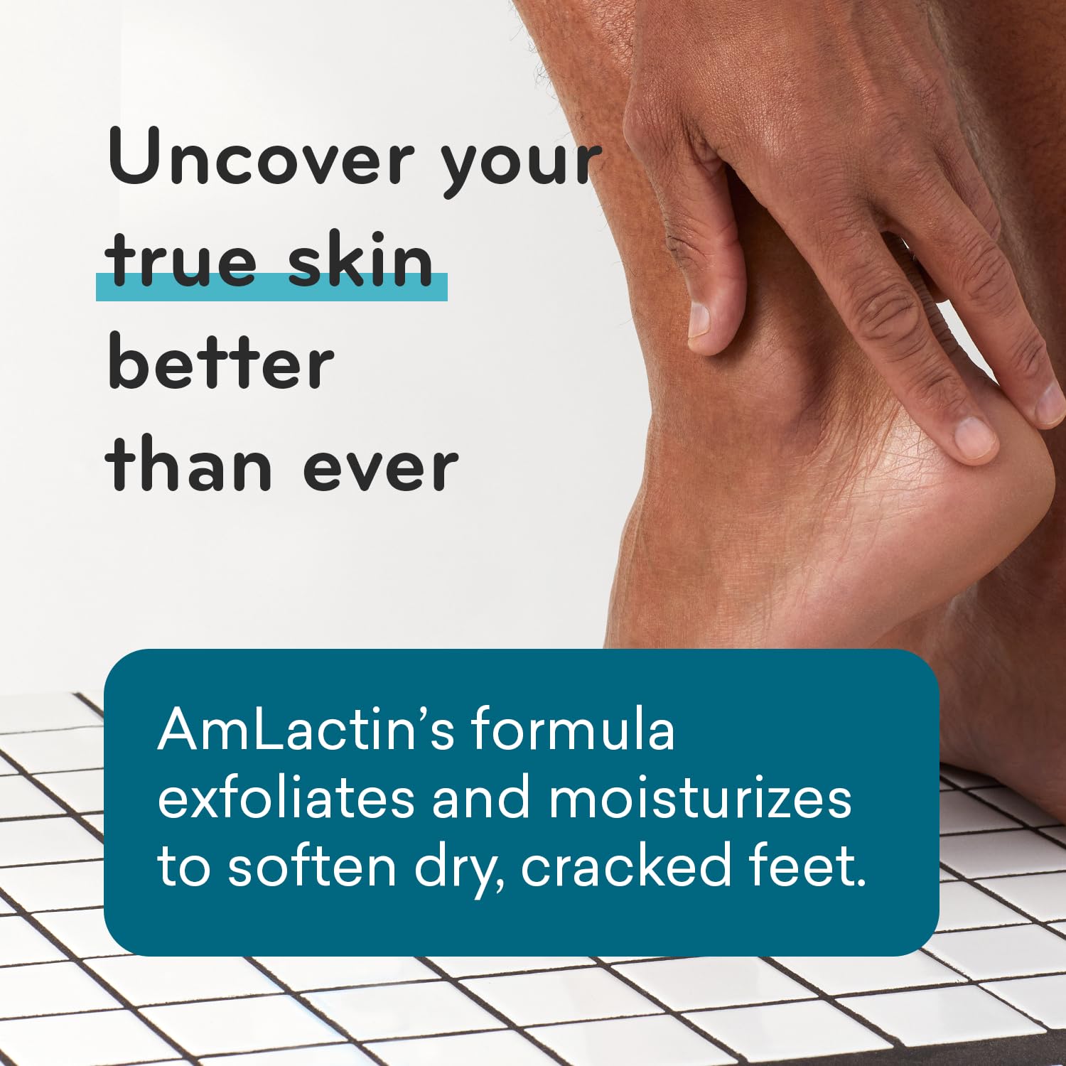 AmLactin Foot Repair Cream - 3 oz Foot Cream with 15% Lactic Acid - Exfoliator and Moisturizer for Dry Skin & Foot Care (Packaging May Vary)