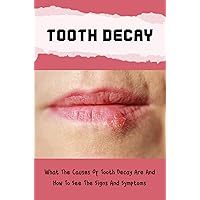 Tooth Decay: What The Causes Of Tooth Decay Are And How To See The Signs And Symptoms
