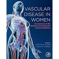 Vascular Disease in Women: An Overview of the Literature and Treatment Recommendations Vascular Disease in Women: An Overview of the Literature and Treatment Recommendations Kindle Paperback