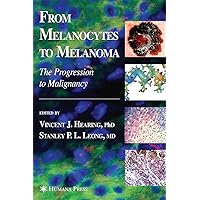 From Melanocytes to Melanoma: The Progression to Malignancy From Melanocytes to Melanoma: The Progression to Malignancy Hardcover Paperback