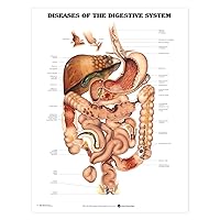 Diseases of The Digestive System Anatomical Chart