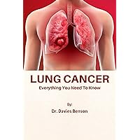 Lung Cancer: Everything You Need To Know Lung Cancer: Everything You Need To Know Kindle Paperback