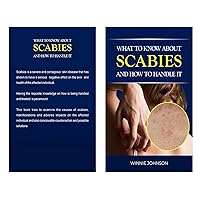 WHAT TO KNOW ABOUT SCABIES AND HOW TO HANDLE IT. WHAT TO KNOW ABOUT SCABIES AND HOW TO HANDLE IT. Kindle Paperback