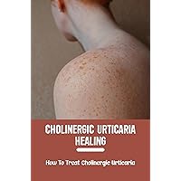 Cholinergic Urticaria Healing: How To Treat Cholinergic Urticaria