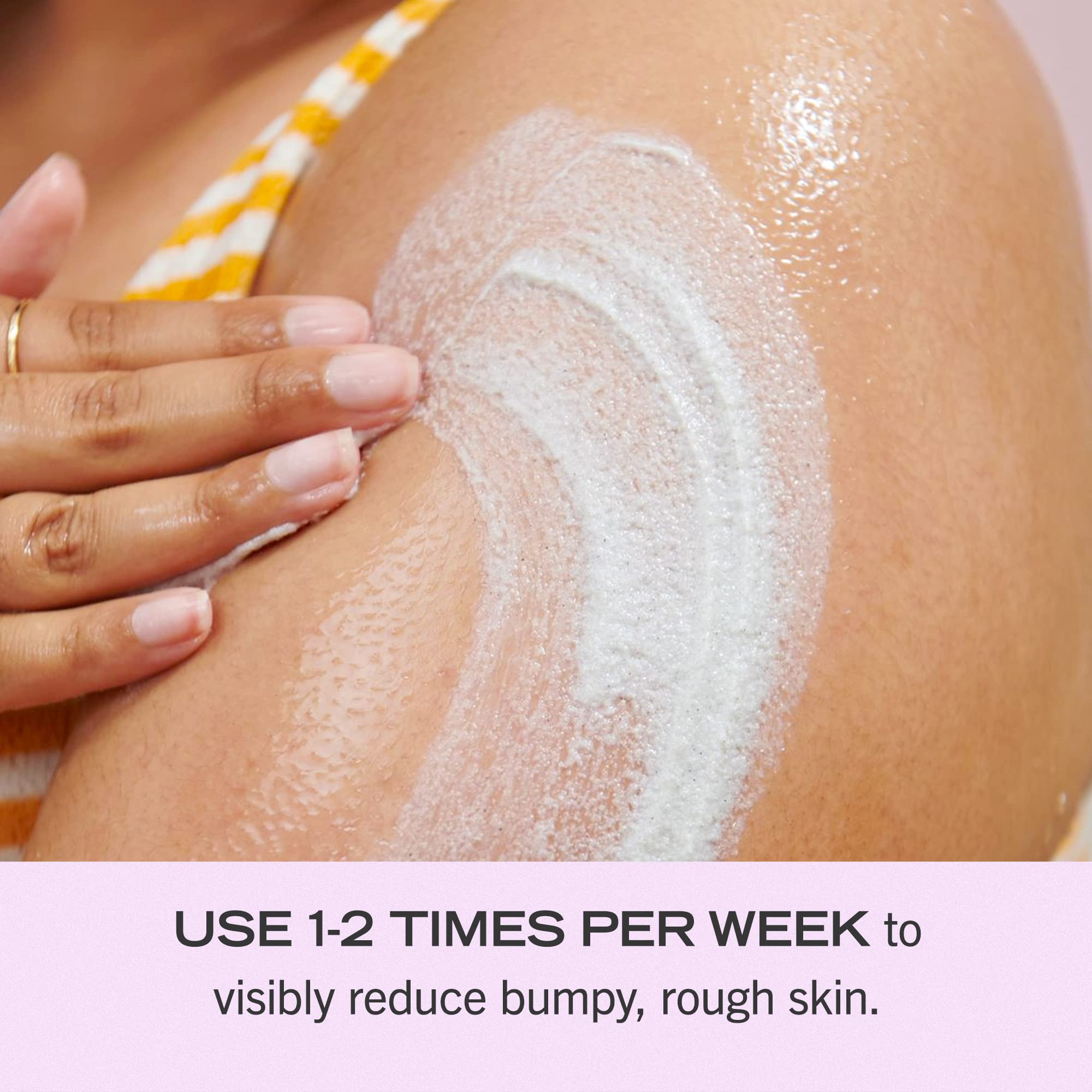 First Aid Beauty KP Bump Eraser Body Scrub Exfoliant for Keratosis Pilaris with 10% AHA – 8 oz