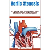Aortic Stenosis : All You Must Know On How To Cure Aortic Stenosis From The Causes, Treatment, Preventions, Management And More Aortic Stenosis : All You Must Know On How To Cure Aortic Stenosis From The Causes, Treatment, Preventions, Management And More Kindle