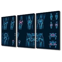 3 Panel Knees and Pelvis X Ray Medical Concept Poster Artwork Canvas Wall Art Pain, Injury or Inflammation Pictures for Bedroom Print on Canvas Framed Ready to Hang 36