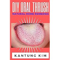 DIY Oral Thrush Natural Home Remedies: The Effective Step By Step Guide To Permanently End Oral Thrush DIY Oral Thrush Natural Home Remedies: The Effective Step By Step Guide To Permanently End Oral Thrush Paperback Kindle