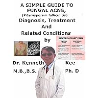 A Simple Guide To Fungal Acne, (Pityrosporum folliculitis) Diagnosis, Treatment And Related Conditions A Simple Guide To Fungal Acne, (Pityrosporum folliculitis) Diagnosis, Treatment And Related Conditions Kindle
