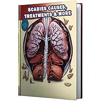 Scabies Causes, Treatments & More: Learn about the causes and various treatments for scabies, a contagious skin infestation caused by mites. Scabies Causes, Treatments & More: Learn about the causes and various treatments for scabies, a contagious skin infestation caused by mites. Paperback