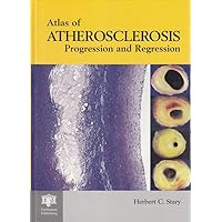 An Atlas of Atherosclerosis Progression and Regression An Atlas of Atherosclerosis Progression and Regression Hardcover