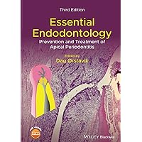 Essential Endodontology: Prevention and Treatment of Apical Periodontitis Essential Endodontology: Prevention and Treatment of Apical Periodontitis Hardcover Kindle Paperback