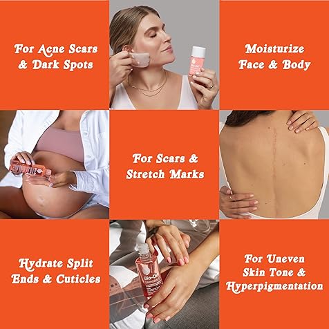 Bio-Oil Skincare Body Oil, Vitamin E Serum for Scars & Stretchmarks, Dermatologist Recommended, All Skin Types, 6.7 oz