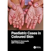 Paediatric Cases in Coloured Skin Paediatric Cases in Coloured Skin Kindle Hardcover Paperback