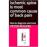 Ischemic spine is most common cause of back pain: How to diagnose and treat Ischemic spine is most common cause of back pain: How to diagnose and treat Kindle