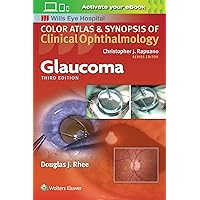 Glaucoma (Color Atlas and Synopsis of Clinical Ophthalmology) Glaucoma (Color Atlas and Synopsis of Clinical Ophthalmology) Paperback Kindle