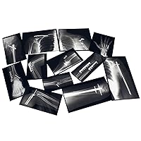 Roylco R-59255 Fixed Bones X-Rays, Black/White, 14 Pieces, Model:R59255