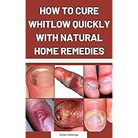 HOW TO CURE WHITLOW QUICKLY WITH NATURAL HOME REMEDIES HOW TO CURE WHITLOW QUICKLY WITH NATURAL HOME REMEDIES Kindle Paperback