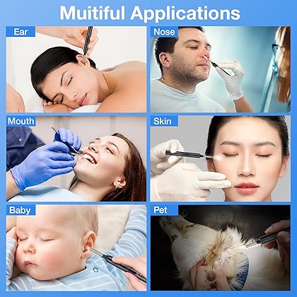 Ear Wax Removal with Camera, Earwax Remover Tool, 1296P FHD Wireless Ear Otoscope with 6 LED Lights, 6 Ear Spoon & 6 Traditional Tools Ear Wax Removal Kit for iPhone, iPad & Android Smart Phone