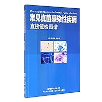 Common fungal infectious disease direct mirror test(Chinese Edition)