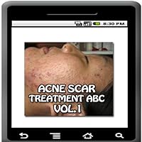 Acne Scar Treatment ABC
