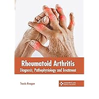 Rheumatoid Arthritis: Diagnosis, Pathophysiology and Treatment